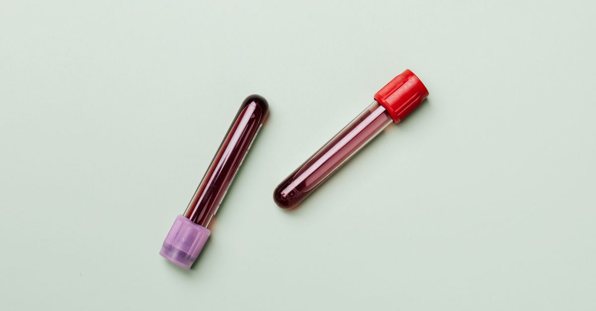 Two blood sample tubes on a plain pale green background